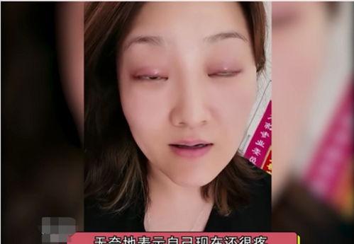 双眼皮失败视频,警惕术后风险与修复要点