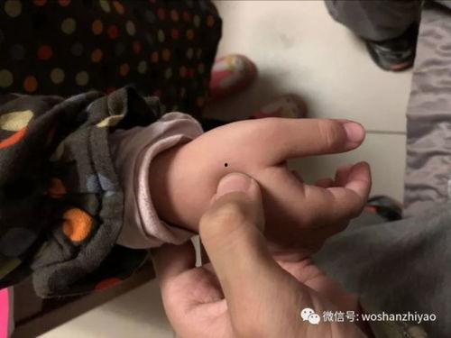 咳嗽推拿视频,咳嗽推拿视频教学，缓解咳嗽不适