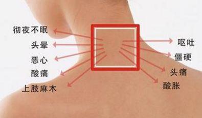 颈椎病视频,视频解析全方位攻略