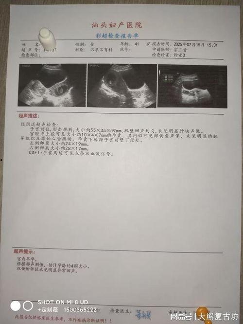 nt视频,揭秘热门话题背后的故事
